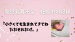 胎児発育不全　加奈 FGR